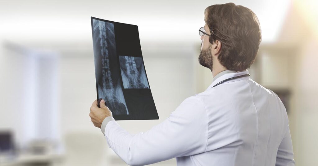 Displasia: o que é, como diagnosticar e quais são as opções de tratamento